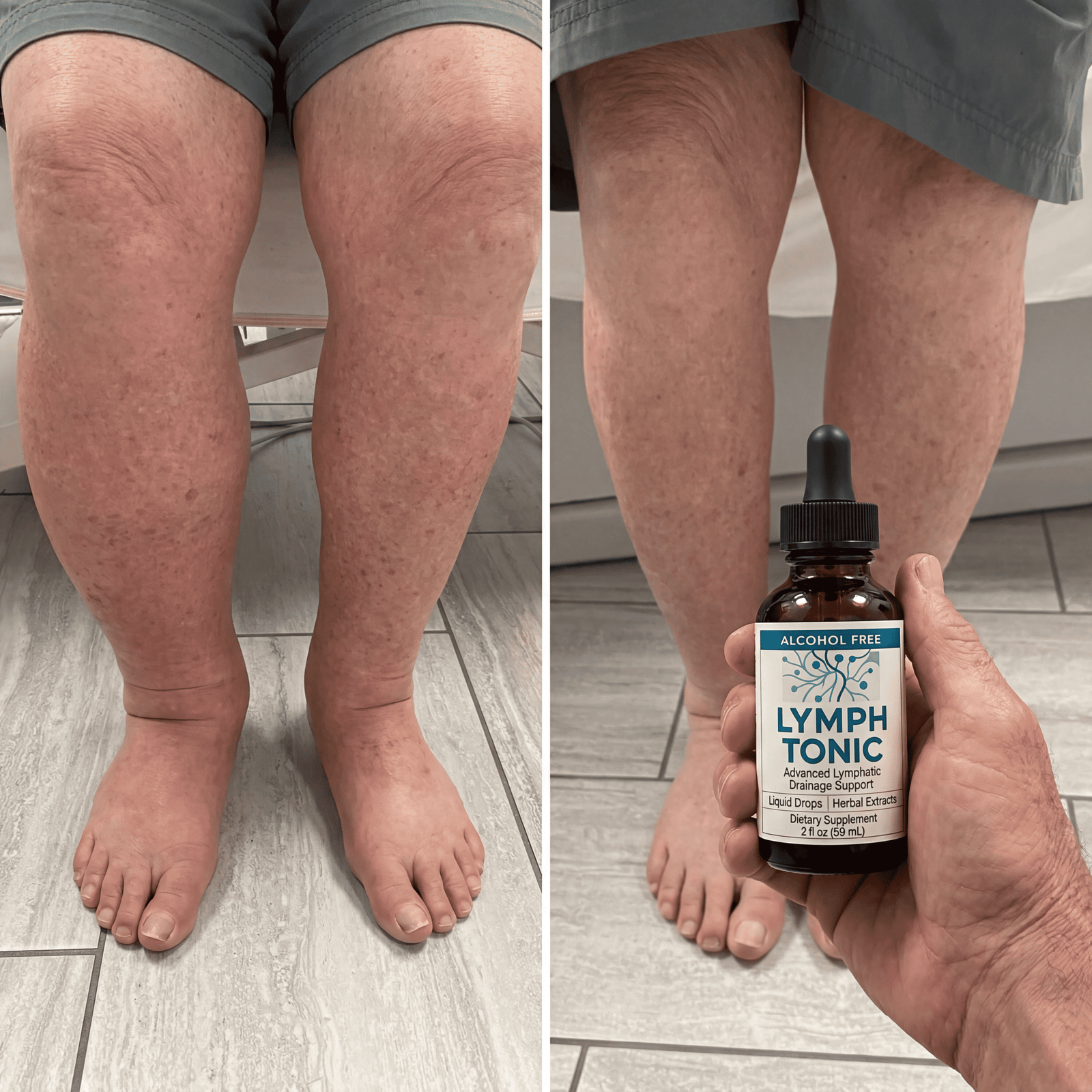 Lymph Tonic