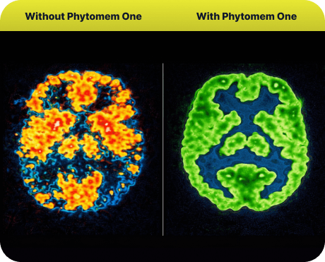 Phytomem One Review: 10 Benefits & Real Results Explained 7 brain before after