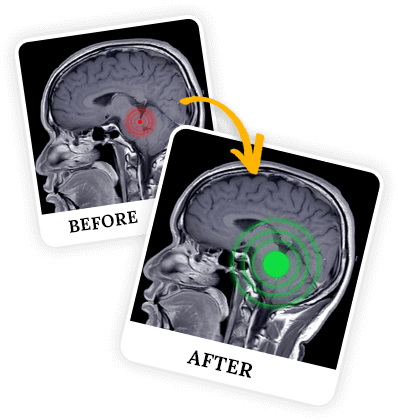 Billionaire Brain Wave Review 2026: Honest Analysis, Benefits & Side Effects 5 s13img